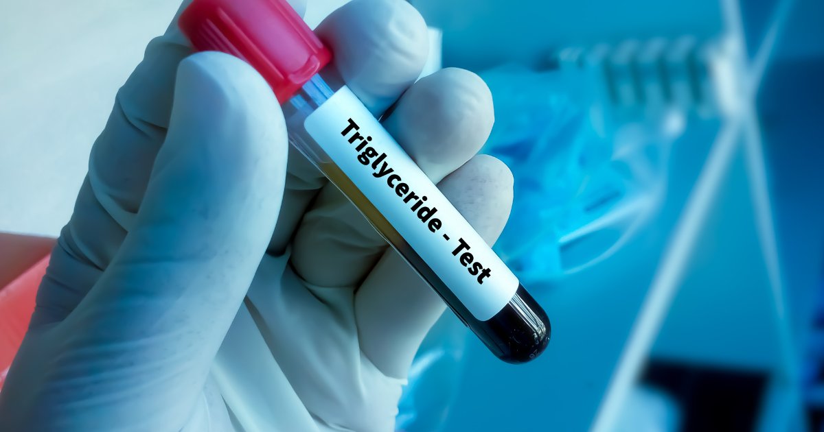Mano enguantada sostiene un tubo de muestra para prueba de triglicéridos en un laboratorio